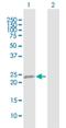 Reticulon 3 antibody, H00010313-B01P, Novus Biologicals, Western Blot image 