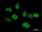 tRNA-splicing endonuclease subunit Sen34 antibody, H00079042-B01P, Novus Biologicals, Immunocytochemistry image 