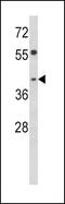 Transducer Of ERBB2, 2 antibody, GTX81931, GeneTex, Western Blot image 