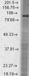 Hyperpolarization Activated Cyclic Nucleotide Gated Potassium And Sodium Channel 2 antibody, GTX41986, GeneTex, Western Blot image 