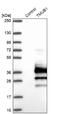 Transmembrane And Ubiquitin Like Domain Containing 1 antibody, NBP1-86731, Novus Biologicals, Western Blot image 