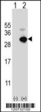 Glutathione S-Transferase Omega 1 antibody, 61-607, ProSci, Western Blot image 