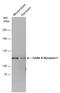 Gamma-Aminobutyric Acid Type B Receptor Subunit 1 antibody, GTX133165, GeneTex, Western Blot image 