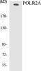 RNA Polymerase II Subunit A antibody, EKC1479, Boster Biological Technology, Western Blot image 