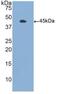 Colony Stimulating Factor 2 Receptor Alpha Subunit antibody, MBS2004012, MyBioSource, Western Blot image 