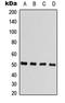 Arrestin Beta 1 antibody, LS-C358912, Lifespan Biosciences, Western Blot image 