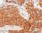 Anoctamin 1 antibody, ab53213, Abcam, Immunohistochemistry paraffin image 