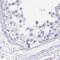 Myozenin 1 antibody, NBP1-85439, Novus Biologicals, Immunohistochemistry paraffin image 