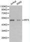 Interferon Regulatory Factor 5 antibody, LS-C192402, Lifespan Biosciences, Western Blot image 