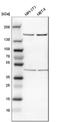 Rho Associated Coiled-Coil Containing Protein Kinase 1 antibody, NBP1-82450, Novus Biologicals, Western Blot image 