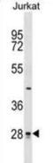 CTD Small Phosphatase 1 antibody, abx029020, Abbexa, Western Blot image 