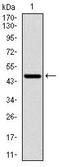 Ribosomal Protein S6 Kinase B1 antibody, MA5-17168, Invitrogen Antibodies, Western Blot image 