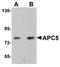 Anaphase Promoting Complex Subunit 5 antibody, orb75410, Biorbyt, Western Blot image 
