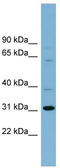 Chromosome 22 Open Reading Frame 31 antibody, TA344504, Origene, Western Blot image 