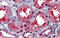 Ceramide Synthase 2 antibody, 25-078, ProSci, Immunohistochemistry paraffin image 