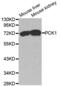 Phosphoenolpyruvate Carboxykinase 1 antibody, abx001653, Abbexa, Western Blot image 