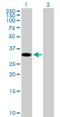 Zinc Finger Protein 101 antibody, H00094039-B01P, Novus Biologicals, Western Blot image 