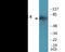 Protein kinase C delta type antibody, EKC2175, Boster Biological Technology, Western Blot image 