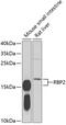 Retinol Binding Protein 2 antibody, GTX33462, GeneTex, Western Blot image 