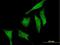 RIO Kinase 2 antibody, H00055781-B01P, Novus Biologicals, Immunofluorescence image 