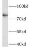 Leucine Rich Repeat And Ig Domain Containing 1 antibody, FNab04792, FineTest, Western Blot image 