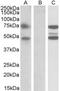 Asparagine Synthetase Domain Containing 1 antibody, MBS422592, MyBioSource, Western Blot image 