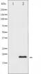 Stathmin 1 antibody, abx011943, Abbexa, Western Blot image 