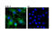 Ras-related protein Rab-27A antibody, 95394S, Cell Signaling Technology, Immunocytochemistry image 
