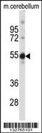 Testis-specific Y-encoded-like protein 5 antibody, 57-138, ProSci, Western Blot image 