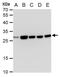 Triosephosphate Isomerase 1 antibody, NBP2-43825, Novus Biologicals, Western Blot image 