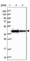 Putative ribosome-binding factor A, mitochondrial antibody, PA5-59587, Invitrogen Antibodies, Western Blot image 