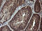 Galectin 3 antibody, LS-C338107, Lifespan Biosciences, Immunohistochemistry paraffin image 