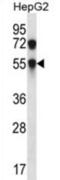 Carbohydrate Sulfotransferase 8 antibody, abx027048, Abbexa, Western Blot image 