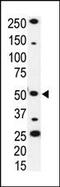 Interleukin 1 Receptor Associated Kinase 4 antibody, MBS9202564, MyBioSource, Western Blot image 