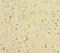 Interferon Alpha And Beta Receptor Subunit 2 antibody, LS-C370731, Lifespan Biosciences, Immunohistochemistry paraffin image 