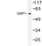 Guanylate Binding Protein 1 antibody, LS-C177346, Lifespan Biosciences, Western Blot image 