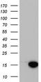 Microtubule Associated Protein 1 Light Chain 3 Alpha antibody, LS-C336853, Lifespan Biosciences, Western Blot image 