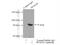 Sperm Associated Antigen 16 antibody, 16883-1-AP, Proteintech Group, Immunoprecipitation image 