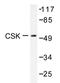 C-Terminal Src Kinase antibody, AP20298PU-N, Origene, Western Blot image 