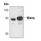 ENAH Actin Regulator antibody, PA5-17115, Invitrogen Antibodies, Western Blot image 