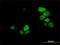 Ubiquitin Like With PHD And Ring Finger Domains 1 antibody, H00029128-M02, Novus Biologicals, Immunocytochemistry image 