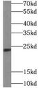 Twist Family BHLH Transcription Factor 1 antibody, FNab09117, FineTest, Western Blot image 