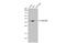 Hydroxysteroid 17-Beta Dehydrogenase 3 antibody, GTX114480, GeneTex, Western Blot image 