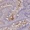 Interleukin 1 Receptor Type 1 antibody, NBP2-48589, Novus Biologicals, Immunohistochemistry paraffin image 