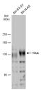 Neurotrophic Receptor Tyrosine Kinase 1 antibody, GTX132966, GeneTex, Western Blot image 