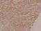 Mitogen-Activated Protein Kinase Kinase 1 antibody, A00292S222, Boster Biological Technology, Immunohistochemistry frozen image 