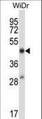 STEAP Family Member 1 antibody, LS-C161556, Lifespan Biosciences, Western Blot image 