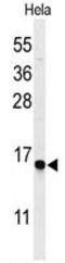 GABA Type A Receptor Associated Protein Like 1 antibody, GTX80541, GeneTex, Western Blot image 