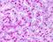 Autophagy Related 5 antibody, GTX48583, GeneTex, Immunohistochemistry paraffin image 