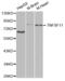 TNF Superfamily Member 11 antibody, abx001988, Abbexa, Western Blot image 